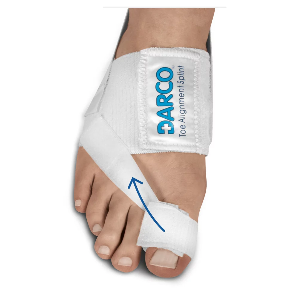 Toe Alignment Splint